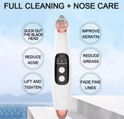 Skinworks | Blackhead Remover with Display - BeautyToon
