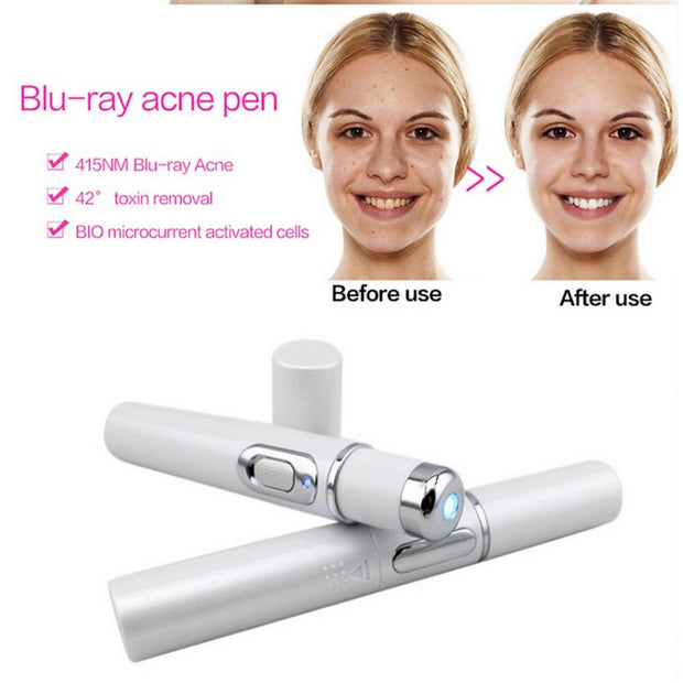 Skinex | Blue Light Acne Laser Pen - BeautyToon