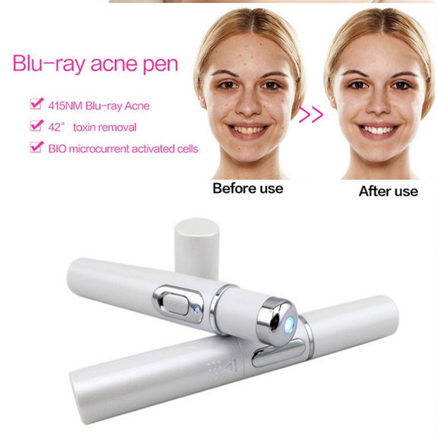 Luzze | Premium Blue Light Acne Pen - BeautyToon