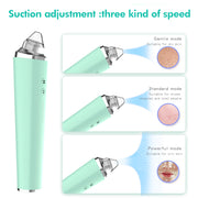 Luzze | Rechargeable Pimple Extractor Pen - BeautyToon