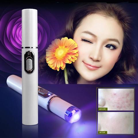 Skinex | Blue Light Acne Laser Pen - BeautyToon