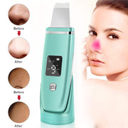 Skinex | Ultrasonic Vibration Blackhead Remover - BeautyToon