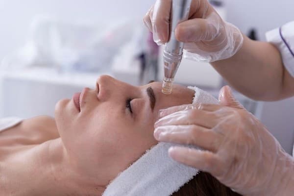Microdermabrasion session