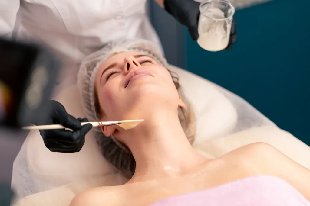 Chemical peel