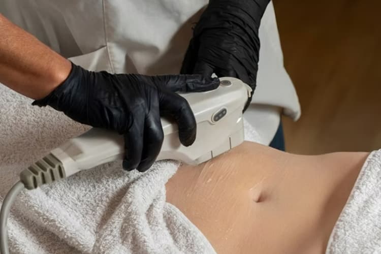 Body contouring