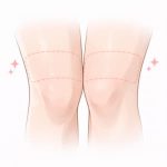 Knee