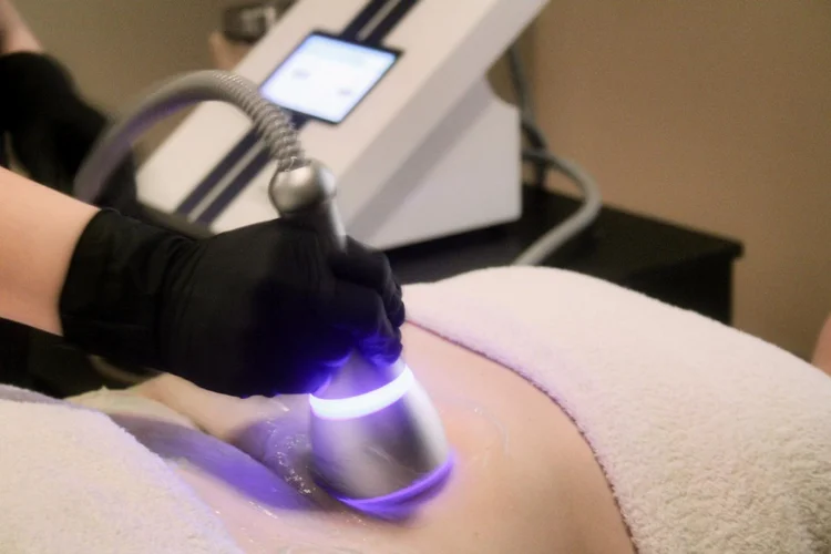 Cryoslim