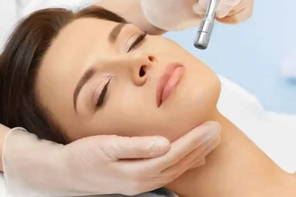 Microdermabrasion